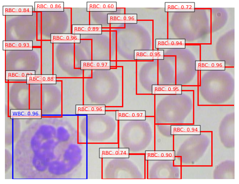 Blood cell detection