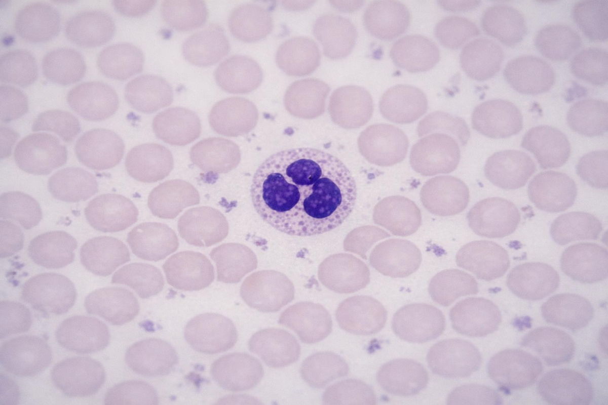 Blood cell detection